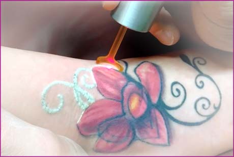 California Life Shows You a New Solution for Removing Unwanted Ink