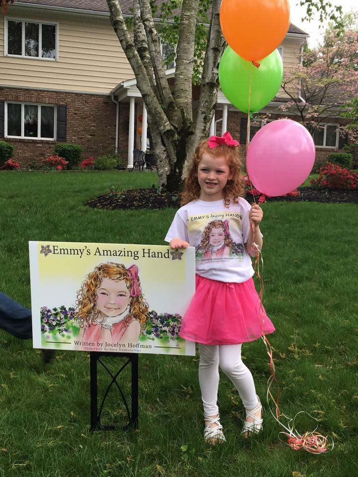 A Mother’s Day wish come true for mom whose daughter receives prosthetic hand