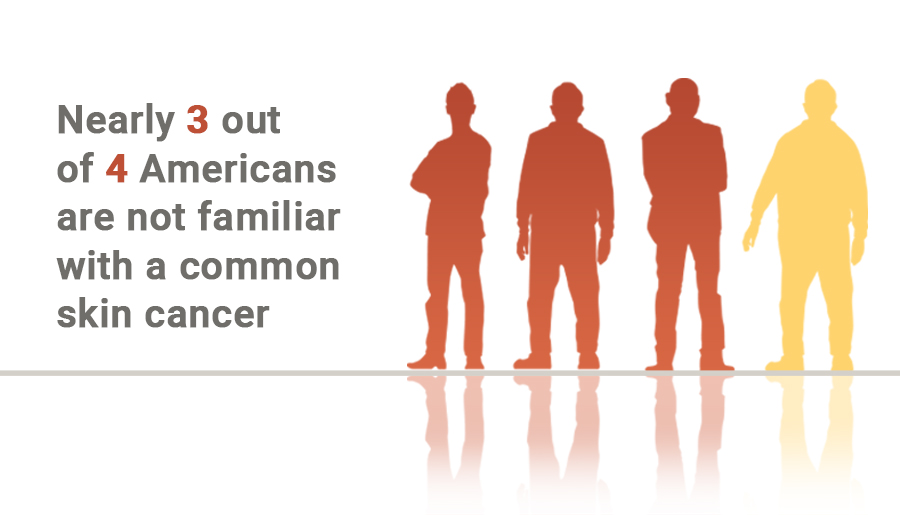 cSCC Skin Cancer is More Commonly Diagnosed than Melanoma. Learn More About the Life-Threatening Cancer.