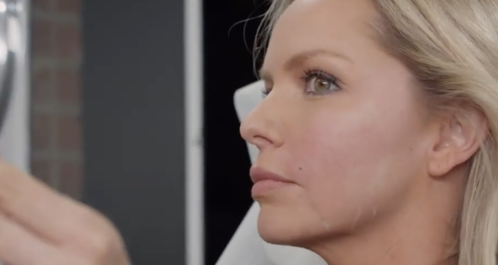 Results without Surgery, the Bussolyft